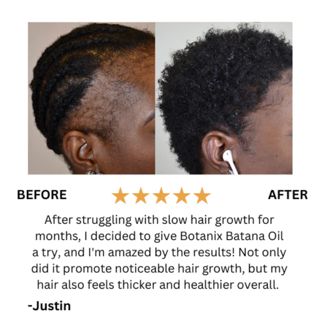 Batana Hair Growth Oil