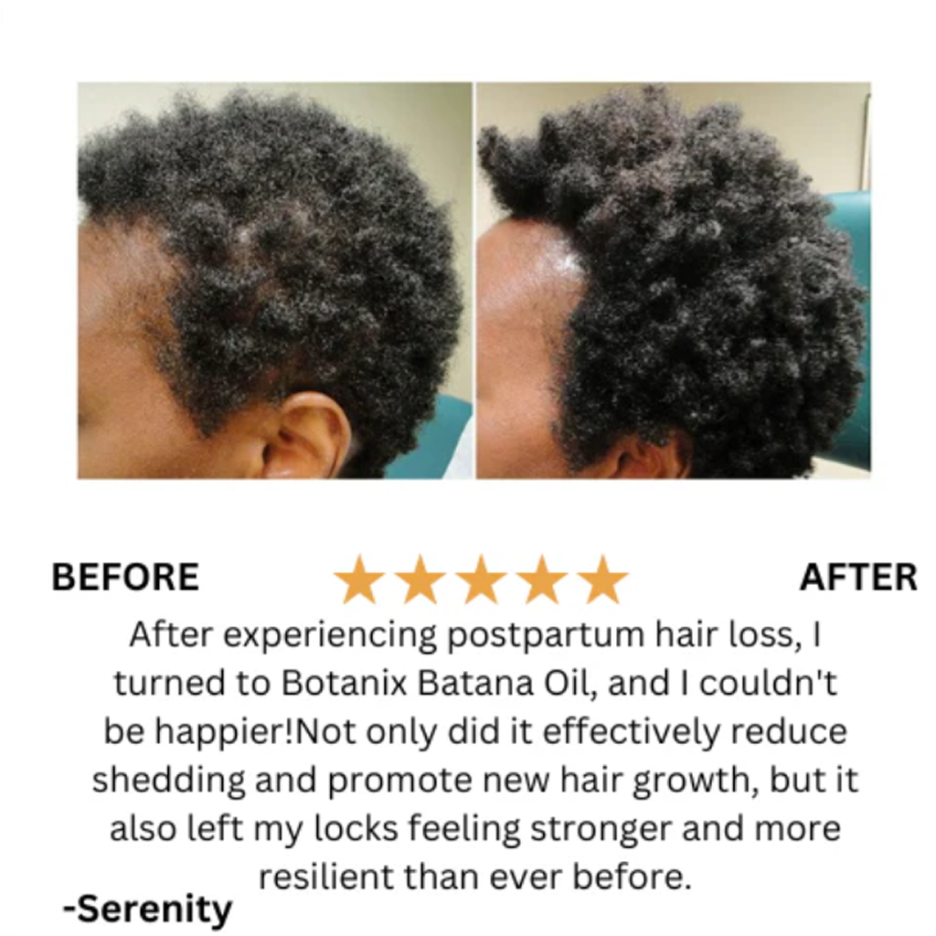 Batana Hair Growth Oil